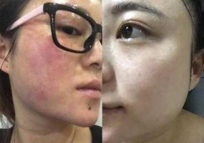 母亲美白蚌埠是私人的吗